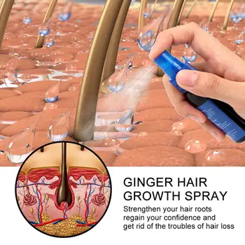 Укрепляющий Выпадение Волос Эффективный Имбирный Спрей Для Роста Волос Natural Regenerating Hair Grower Для Мужчин И Женщин Быстродействующий